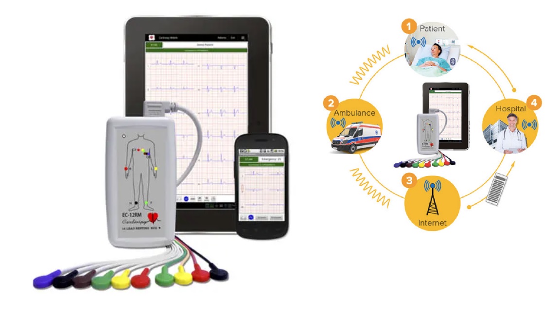 Máy đo điện tim 12 kênh tại giường; tại nhà; trên xe cứu thương loại cầm tay có kết nối Wifi với Smartphone bởi hệ điều hành Android